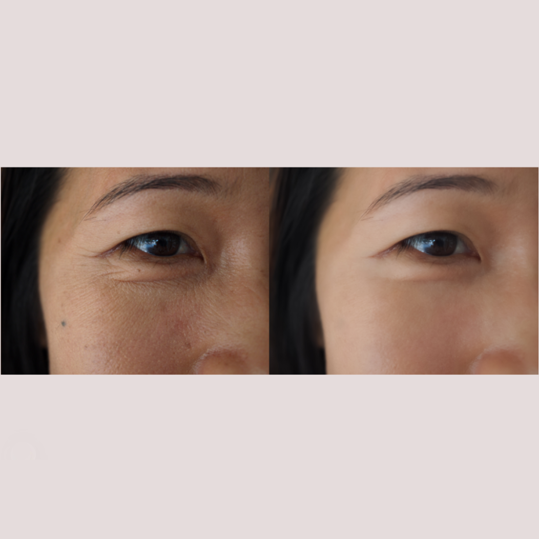Belong Aesthetics - Eye 02.png