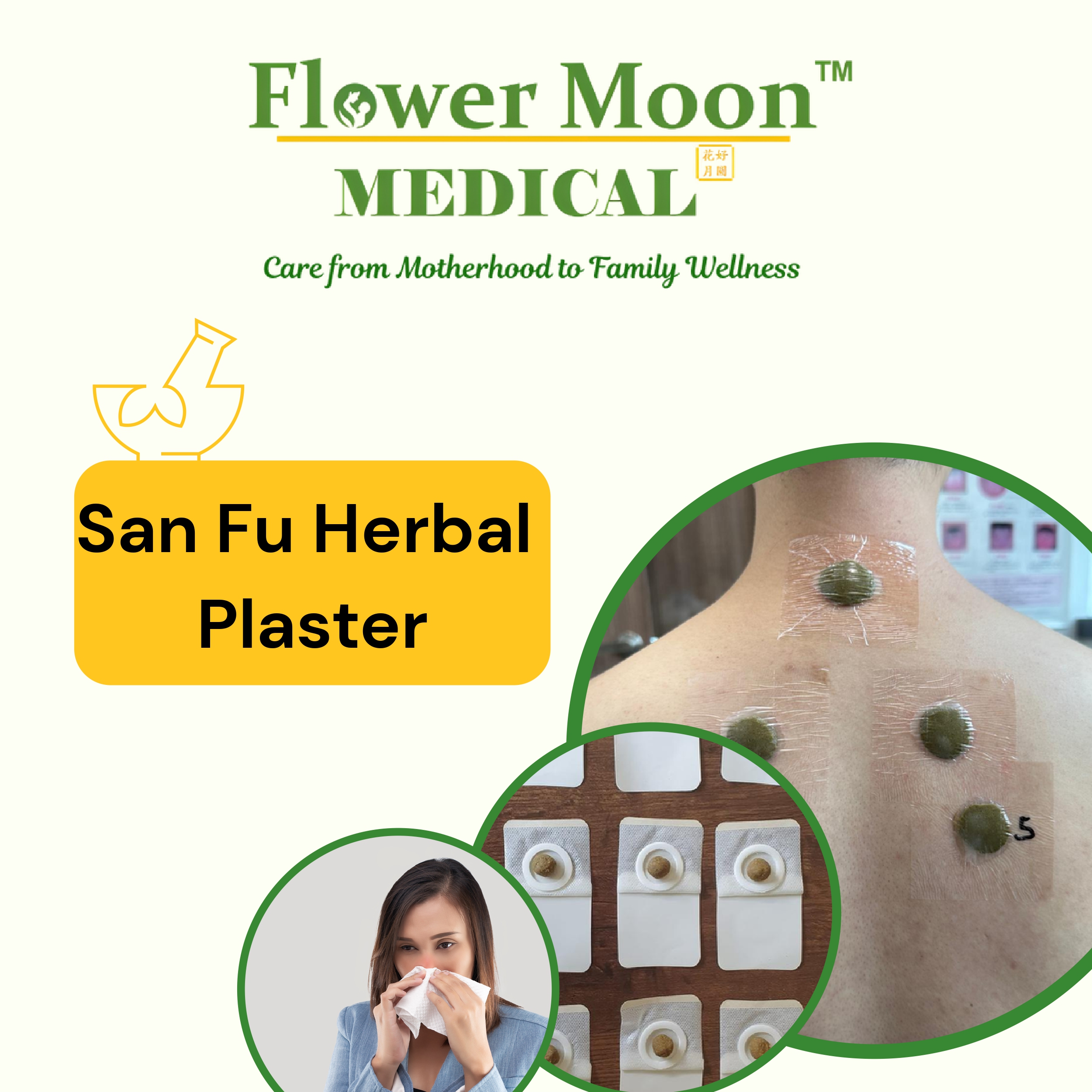 Flower Moon TCM - San Fu Herbal Plaster 3 Sessions - for Sinus, Asthma, Period pain, Joint Pain