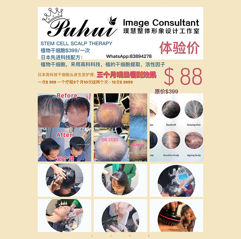 Puhui Image Consultant - STEM CELL SCALP THERAPY